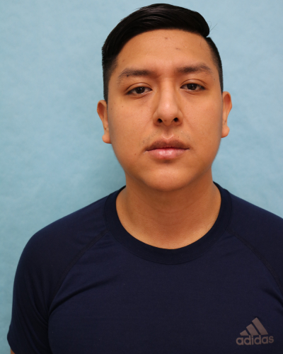 Chin Augmentation Patient