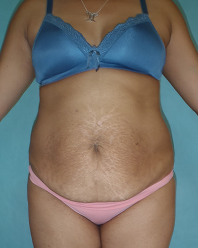 woman posing in front of water